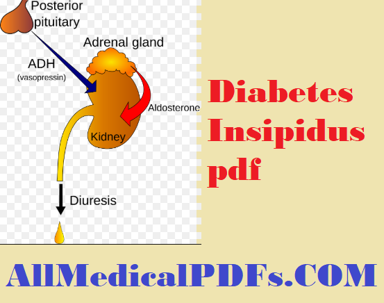Diabetes Insipidus pdf